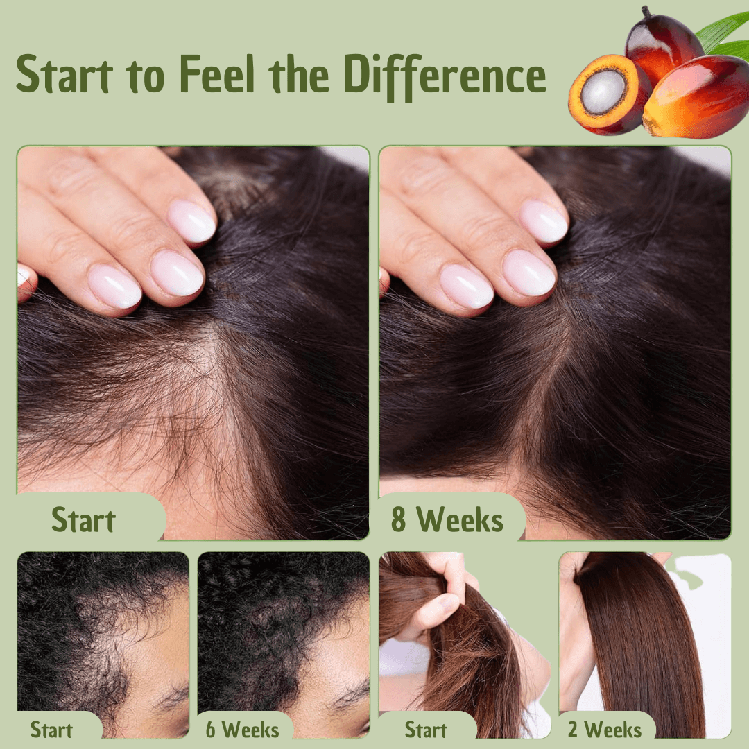 Hair Oil Natural Treatment for Hair Care