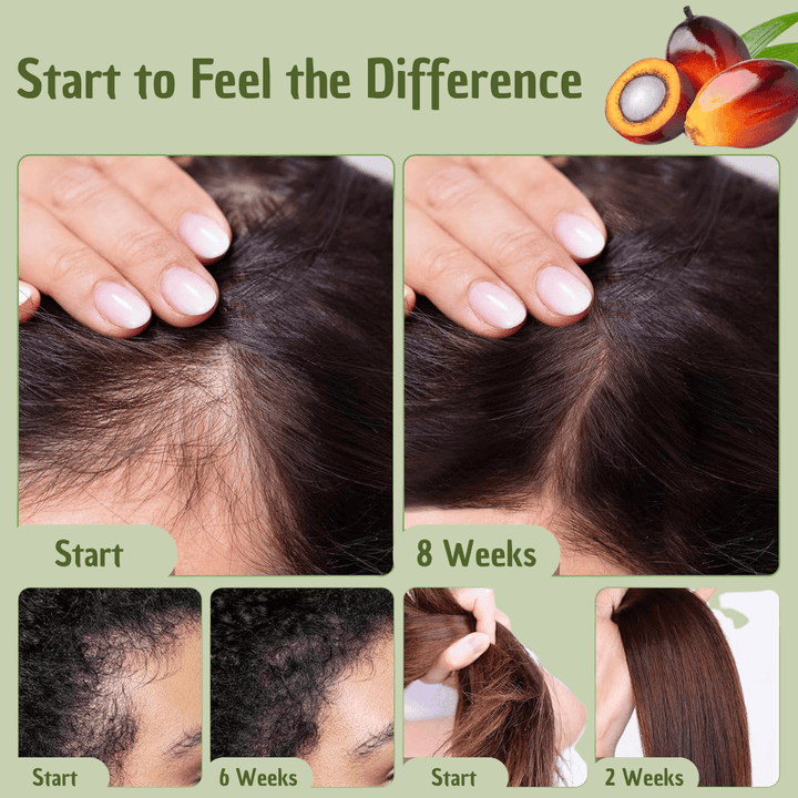 Hair Oil Natural Treatment for Hair Care