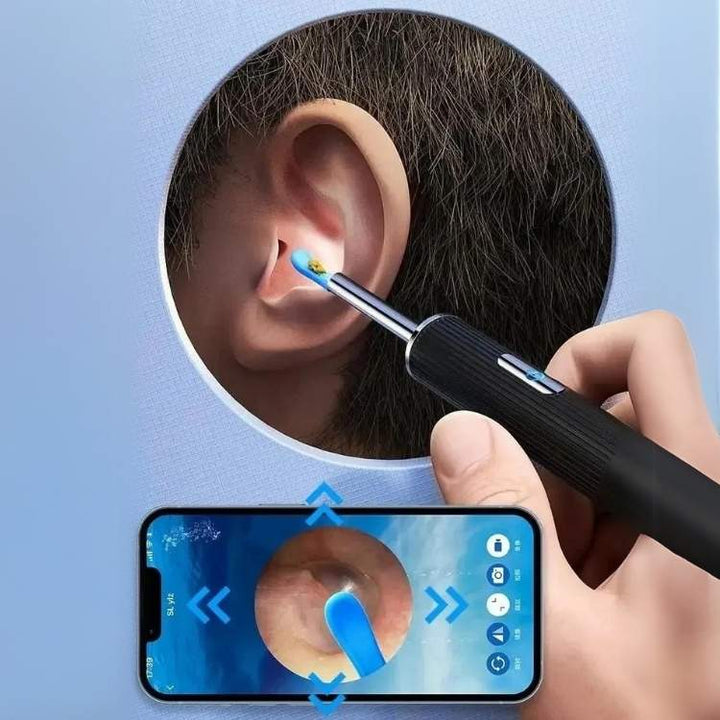 Earwax Removal Kit with Ear Scope and Cleaning Tools Set