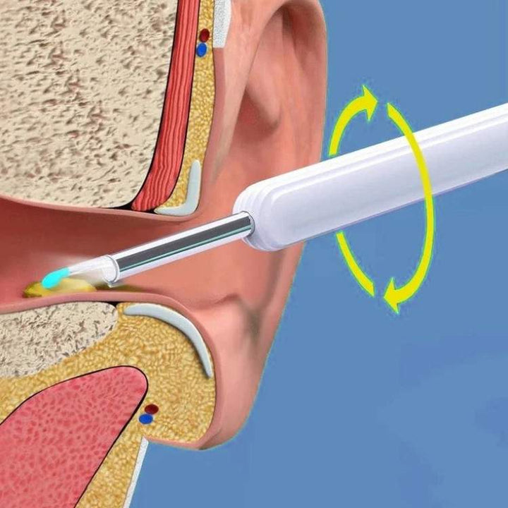 Earwax Removal Kit with Ear Scope and Cleaning Tools Set