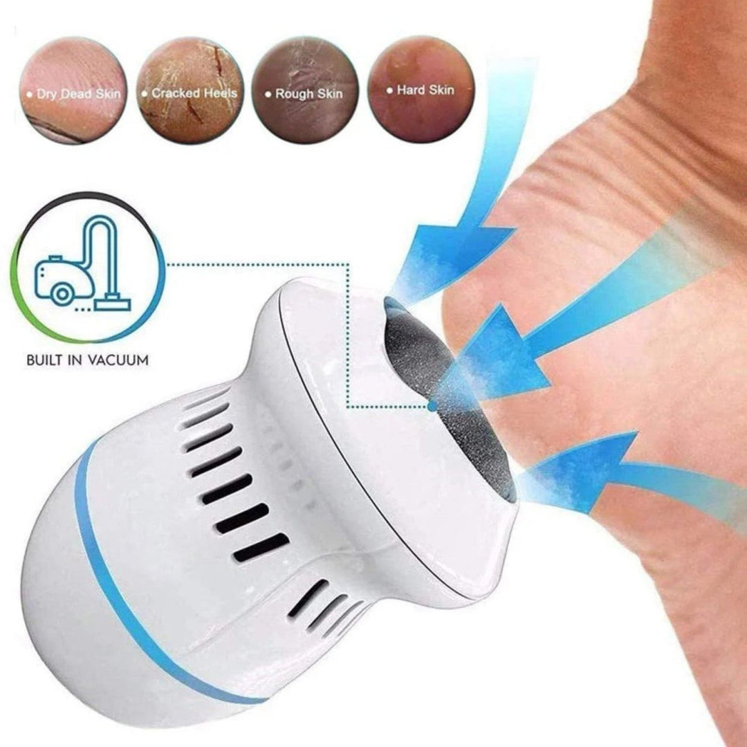 Electric Foot Grinder Pedicure Callus Remover Tool Electric Callus Grinder
